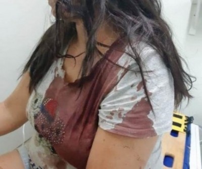 Nova Andradina: Durante briga, mulher sofre ferimentos graves ao ser agredida pelo marido