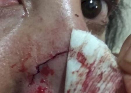 Homem atropela mulher de Nova Andradina duas vezes e ainda agride com socos