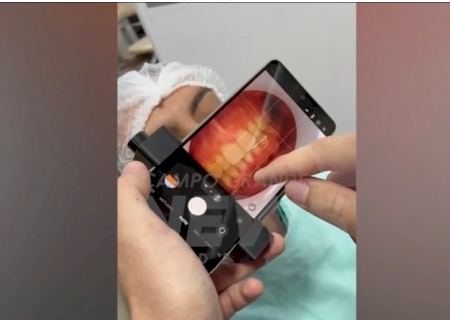 MS integra pesquisa que usa IA para detectar cárie e priorizar demandas no SUS>