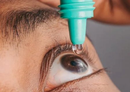 Anvisa suspende importação de colírios e géis de fabricante francesa>