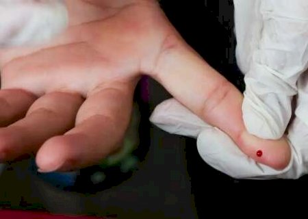Brasil elimina transmissão vertical da hepatite B; MS segue tendência